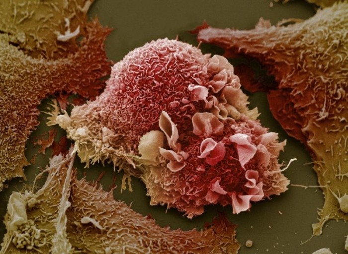 lung cancer cells.jpg